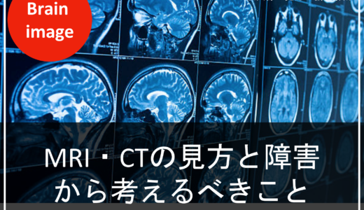 2019年4月開催の脳画像セミナーレポート